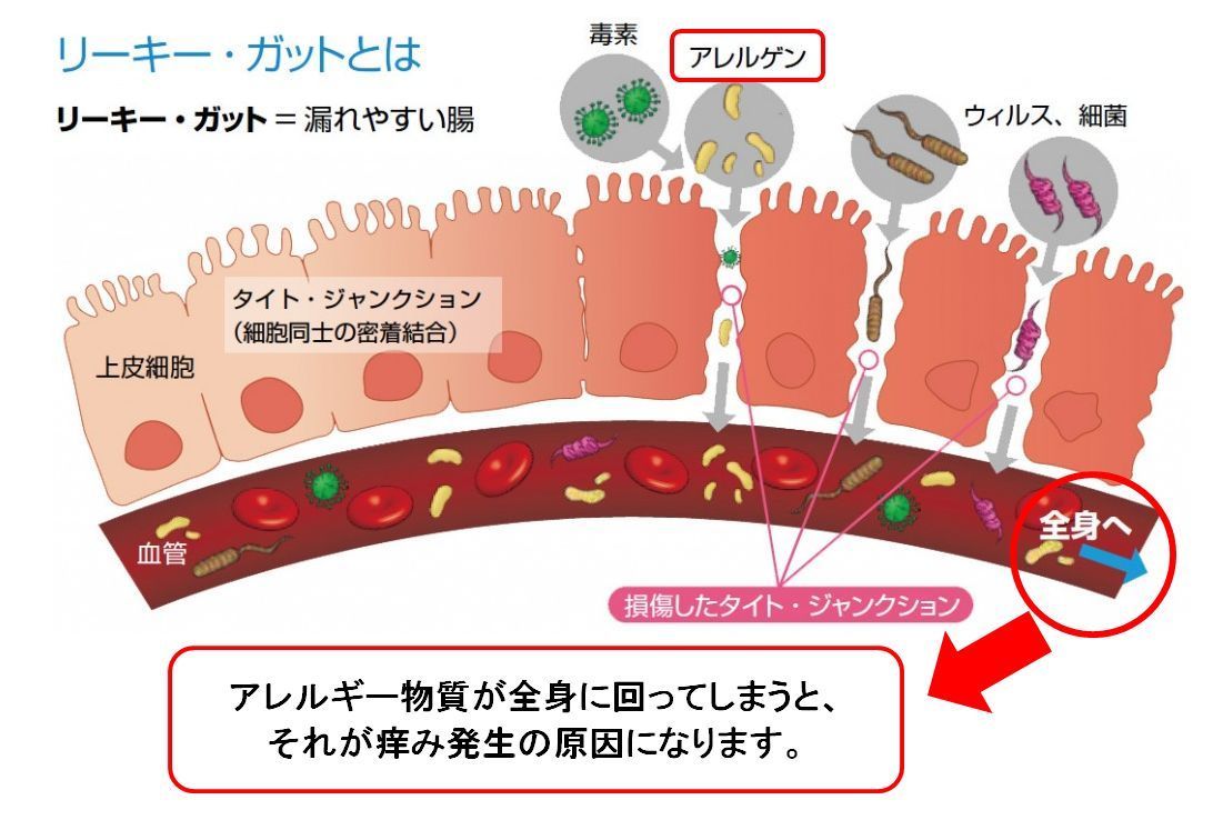 クリックで拡大表示